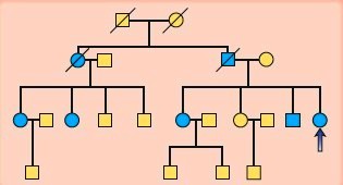 Pedigree of a family with dilated cardiomyopathy