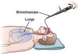 Use of a bronchoscope